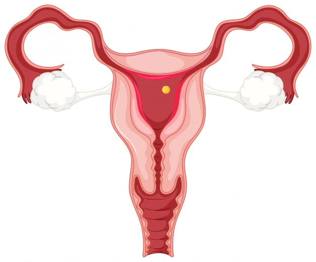 Fibroids in Uterus